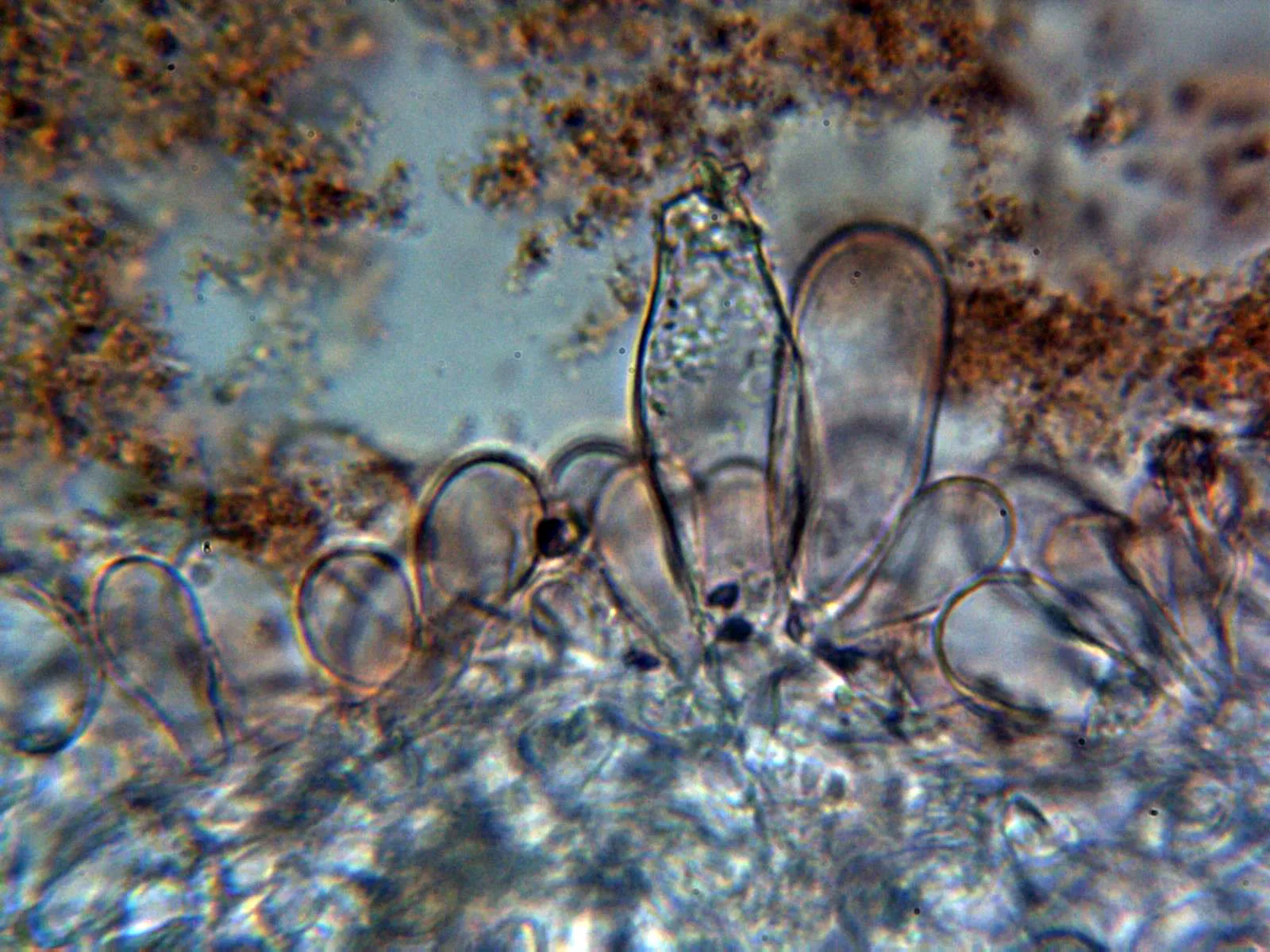 Microscopía de Inocybe phaeodisca - 10 - Queilocistidios 1